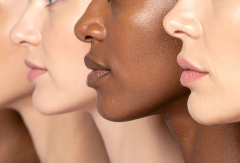 four women showing chins and jawline straightness